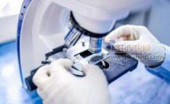 电镜技术论文投sci期刊容易吗