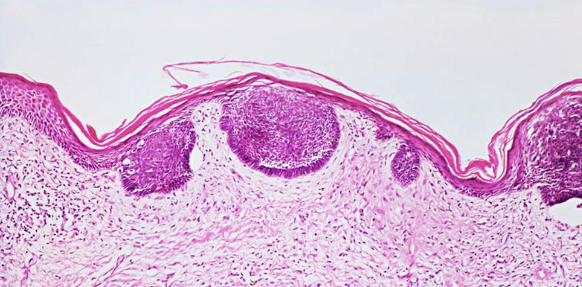 国内关于皮肤病论文投哪些期刊好